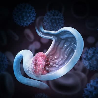 ANEMIA. Información para pacientes.