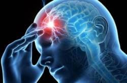 JAQUECA- Migraña. ( Información para pacientes)